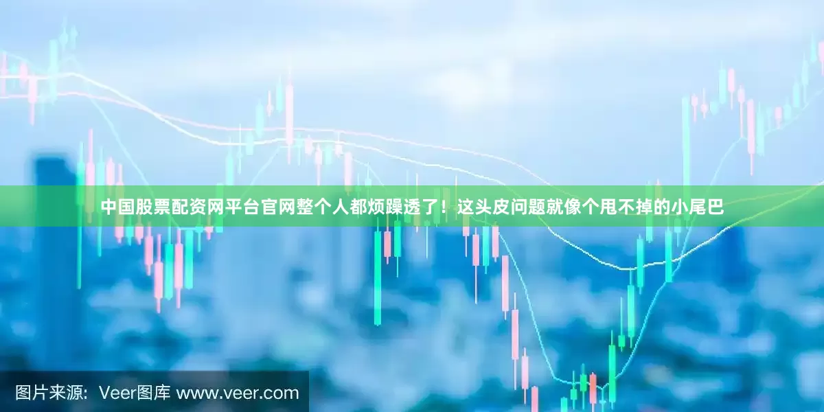中国股票配资网平台官网整个人都烦躁透了！这头皮问题就像个甩不掉的小尾巴